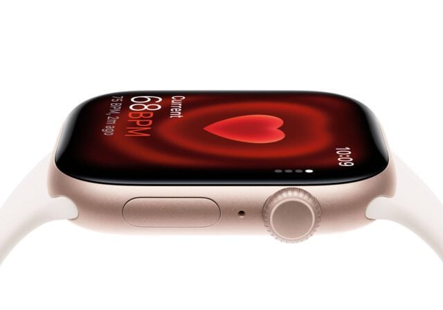 Apple Watch Series 11 product photo